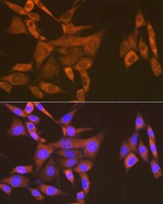 Immunocytochemistry/ Immunofluorescence: USP9x Antibody (7T0S2) [NBP3-16884]