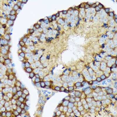 Immunohistochemistry-Paraffin: USP9x Antibody (7T0S2) [NBP3-16884]
