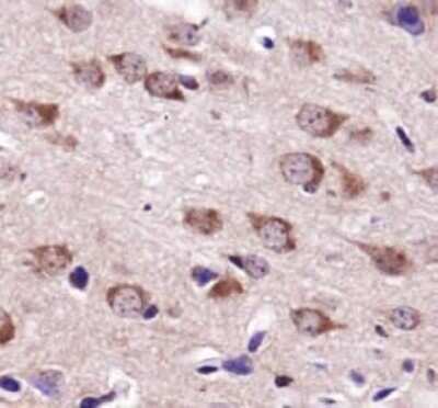 Immunohistochemistry: USP9x Antibody [NBP1-48321]