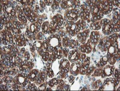 Immunohistochemistry: USP9x Antibody (OTI2G7) - Azide and BSA Free [NBP2-74822]
