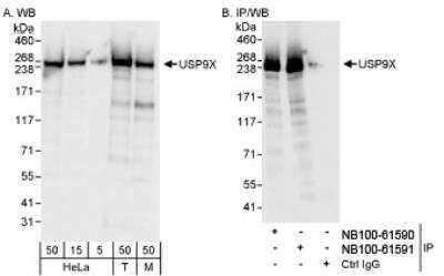 Western Blot: USP9x Antibody [NB100-61591]