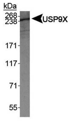 Western Blot: USP9x Antibody [NBP1-48321]