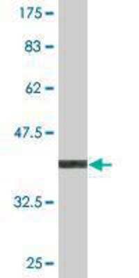 Western Blot: USPL1 Antibody (2F12) [H00010208-M01]