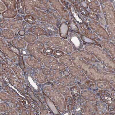 Immunohistochemistry-Paraffin: USPL1 Antibody [NBP1-88974]