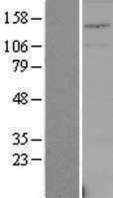 Western Blot: USPL1 Overexpression Lysate [NBP2-04300]