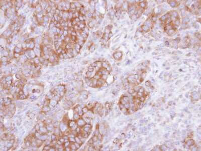 Immunohistochemistry-Paraffin: UST Antibody [NBP1-32585]
