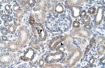 Immunohistochemistry-Paraffin: UST Antibody [NBP1-60042]