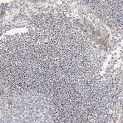 Immunohistochemistry-Paraffin: UST Antibody [NBP1-89383]