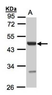 Western Blot: UST Antibody [NBP1-32585]