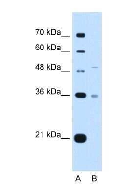 Western Blot: UST Antibody [NBP1-60042]