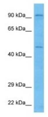 Western Blot: UST Antibody [NBP3-10107]