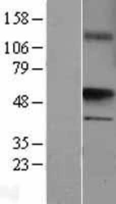 Western Blot: UST Overexpression Lysate [NBL1-17674]