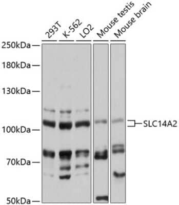 Western Blot: UT2/SLC14A2 AntibodyAzide and BSA Free [NBP2-93774]