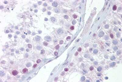 Immunohistochemistry: UTF1 Antibody [NBP3-10884]