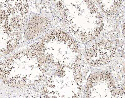 Immunohistochemistry-Paraffin: UTF1 Antibody [NBP3-12788]