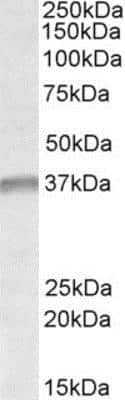 Western Blot: UTF1 Antibody [NBP1-51943]