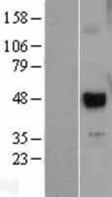 Western Blot: UTF1 Overexpression Lysate [NBL1-17675]