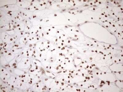 Immunohistochemistry: UTP11L Antibody (OTI5F3) [NBP2-46318]