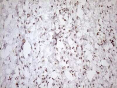 Immunohistochemistry: UTP11L Antibody (OTI5F3) [NBP2-46318]
