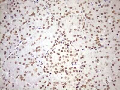 Immunohistochemistry: UTP11L Antibody (OTI5F3) [NBP2-46318]