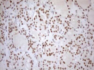 Immunohistochemistry: UTP11L Antibody (OTI5F3) [NBP2-46318]
