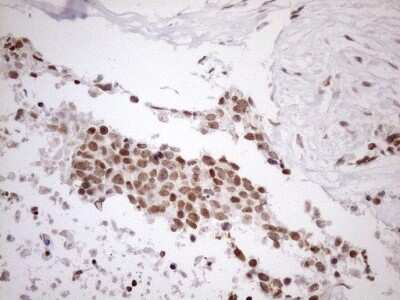 Immunohistochemistry: UTP11L Antibody (OTI5F3) [NBP2-46318]