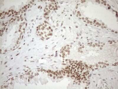 Immunohistochemistry: UTP11L Antibody (OTI5F3) [NBP2-46318]