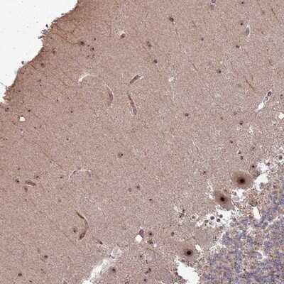 Immunohistochemistry-Paraffin: UTP11L Antibody [NBP1-92567]