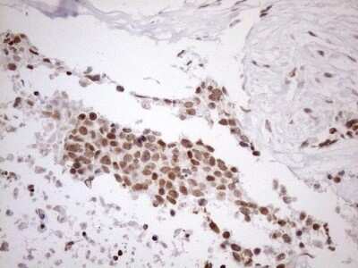 Immunohistochemistry: UTP11L Antibody (OTI5F3) - Azide and BSA Free [NBP2-74823]