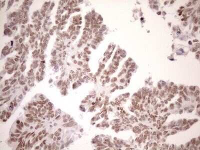 Immunohistochemistry: UTP11L Antibody (OTI5F3) - Azide and BSA Free [NBP2-74823]