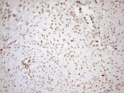 Immunohistochemistry: UTP11L Antibody (OTI5F3) - Azide and BSA Free [NBP2-74823]