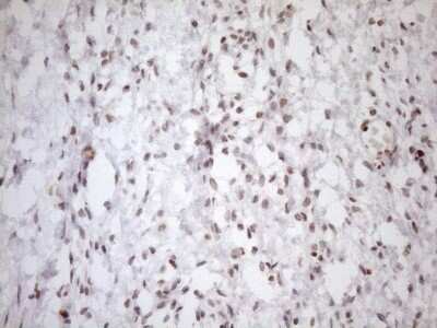 Immunohistochemistry: UTP11L Antibody (OTI5F3) - Azide and BSA Free [NBP2-74823]