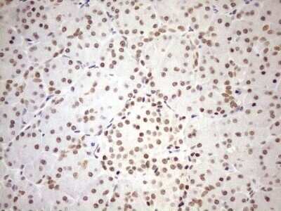 Immunohistochemistry: UTP11L Antibody (OTI5F3) - Azide and BSA Free [NBP2-74823]