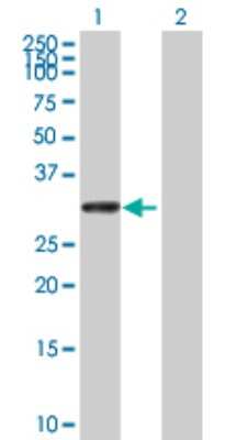 Western Blot: UTP11L Antibody [H00051118-B01P]
