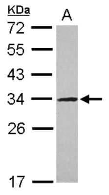 Western Blot: UTP11L Antibody [NBP2-20840]