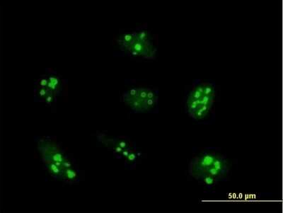 Immunocytochemistry/ Immunofluorescence: UTP14A Antibody [H00010813-B01P]