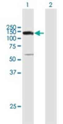 Western Blot: UTP14A Antibody [H00010813-B01P]