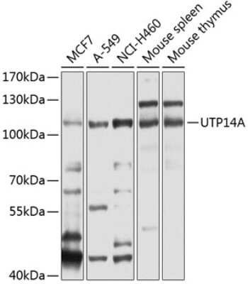 Western Blot: UTP14A AntibodyBSA Free [NBP2-93627]