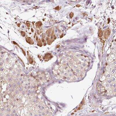 Immunohistochemistry-Paraffin: UTP14C Antibody [NBP2-33701]