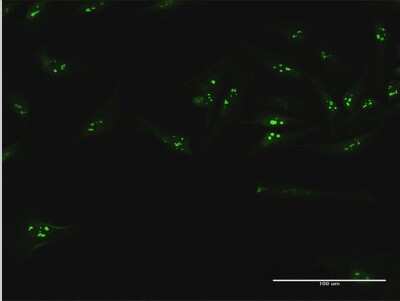 Immunocytochemistry/ Immunofluorescence: UTP18 Antibody [H00051096-B01P]
