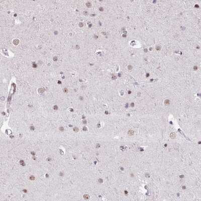 Immunohistochemistry-Paraffin: UTP18 Antibody [NBP2-13511]