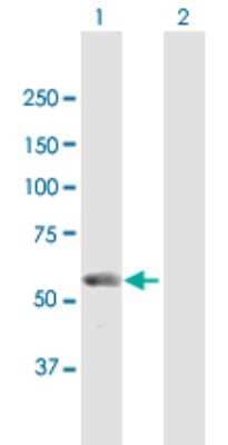 Western Blot: UTP18 Antibody [H00051096-B01P]