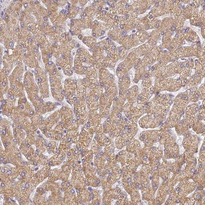 Immunohistochemistry-Paraffin: UTP23 Antibody [NBP1-92568]