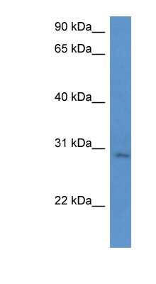 Western Blot: UTP23 Antibody [NBP1-79832]