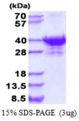 SDS-PAGE: Recombinant Human UTP23 His Protein [NBP2-22936]