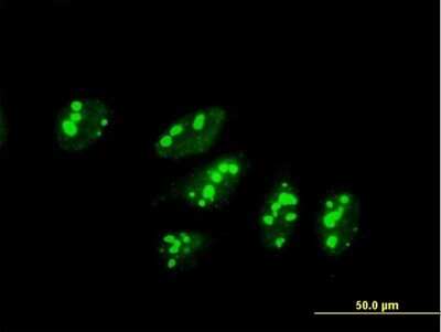 Immunocytochemistry/ Immunofluorescence: UTP3 Antibody [H00057050-B01P]
