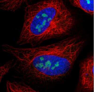 Immunocytochemistry/ Immunofluorescence: UTP3 Antibody [NBP1-85449]