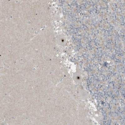 Immunohistochemistry-Paraffin: UTP3 Antibody [NBP1-85449]