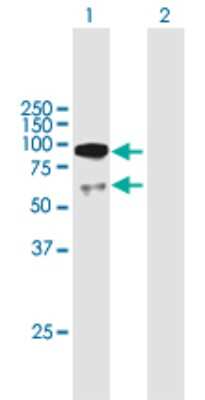 Western Blot: UTP3 Antibody [H00057050-B01P]