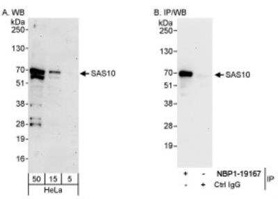 Western Blot: UTP3 Antibody [NBP1-19108]